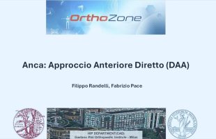 Video Intervento Protesi Totale d’Anca – Accesso Diretto Anteriore