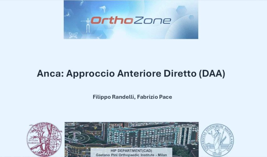 Video Intervento Protesi Totale d’Anca – Accesso Diretto Anteriore