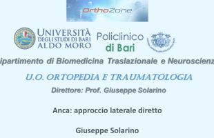 Anca: approccio laterale diretto