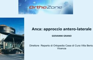 Video Intervento Protesi Totale d’Anca – Accesso Antero-Laterale